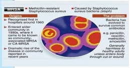 Methicillin-Resistant Staphylococcus aureus (MRSA) infection – AZ Dept. of  Health Services Director's Blog